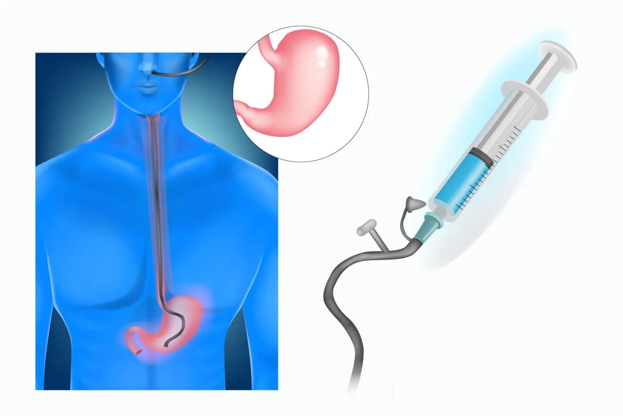 Czy rozmiar ma znaczenie sonda? Jak wybór wpływa na komfort pacjenta